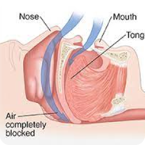 best-ent-doctore-surat